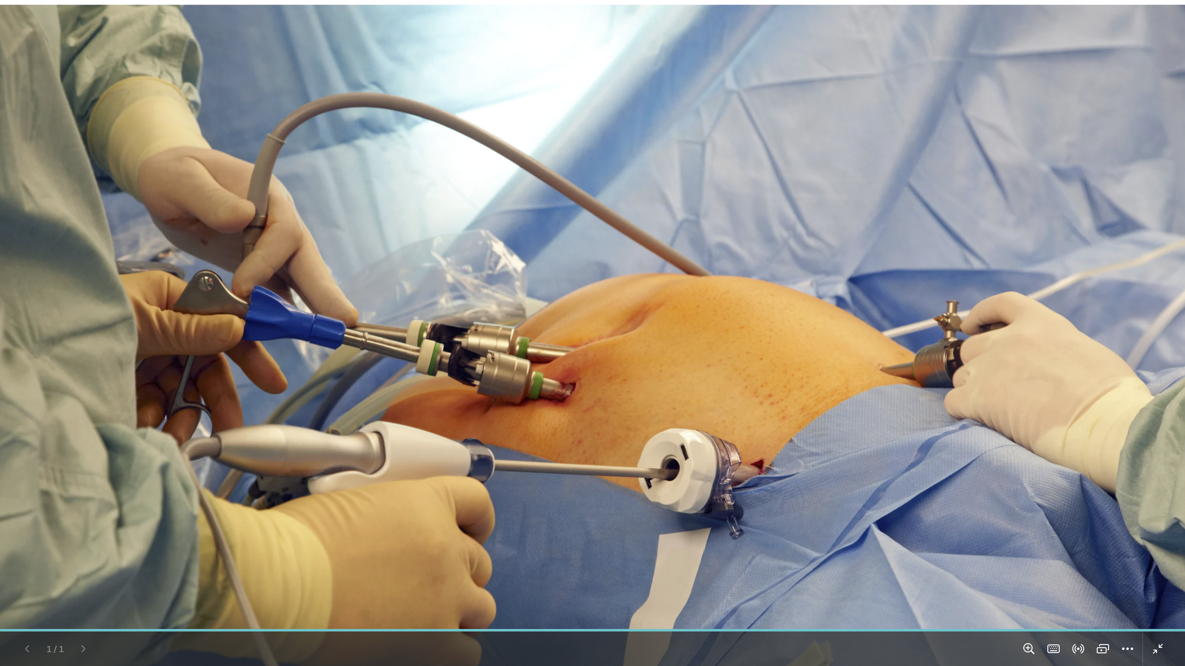 Laparoscopic Surgery